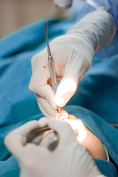 Closeup Vertical Shot Hands Doctor Performing Surgery Nose Patient — Stock Photo, Image