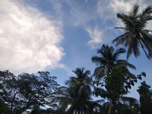 Sebuah Gambar Sudut Rendah Pohon Palem Pada Hari Yang Cerah — Stok Foto