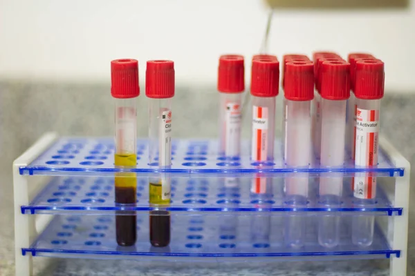 Селективное Фокусирование Двух Трубах Анализа Крови Лаборатории Помещенных Анализ Рядом — стоковое фото