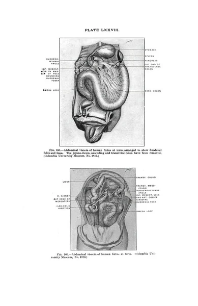 古い解剖書から人間の胎児の腹部のイラスト — ストック写真