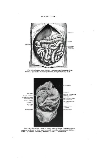 Een Menselijke Foetus Vertex Coccygeale Maat Abdominale Ingewanden Van Een — Stockfoto