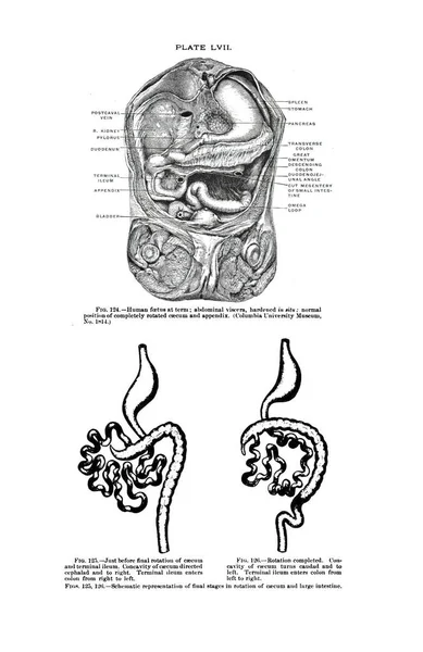 Feto Humano Término Las Vísceras Abdominales Endurecidas Una Ilustración Del —  Fotos de Stock