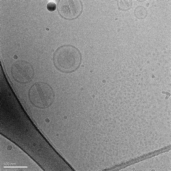 Imagem Electrónica Várias Nanopartículas Lípidos Lipossomas Contendo Fármaco Anticancerígeno Doxorrubicina — Fotografia de Stock