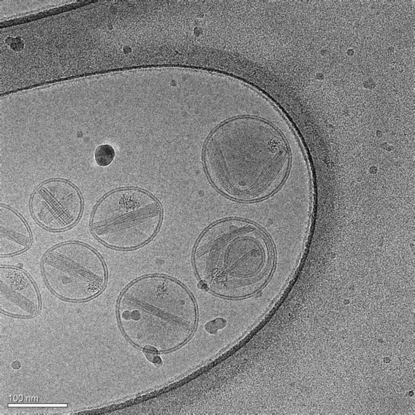Mikrograf Nanopartiklar Gjorda Lipider Som Innehåller Ett Cancerläkemedel Moderna Biomedicinska — Stockfoto