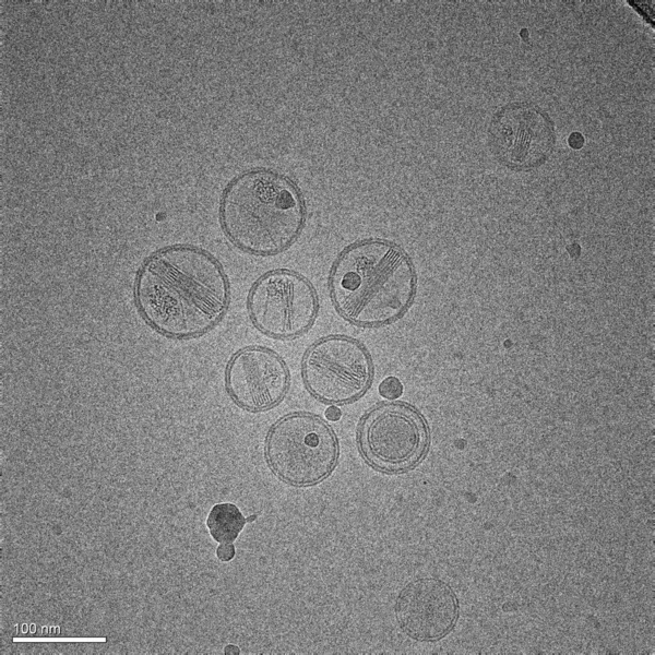 Flera Nanopartiklar Lipider Som Innehåller Ett Läkemedel Mot Cancer Moderna — Stockfoto