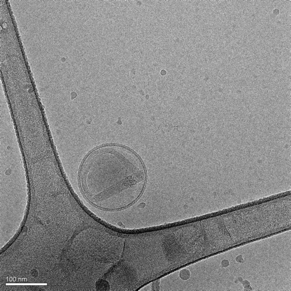 Obrázek Pořízený Kryogenním Elektronovým Mikroskopem Představuje Nanočástice Vyrobené Lipidů Obsahujících — Stock fotografie