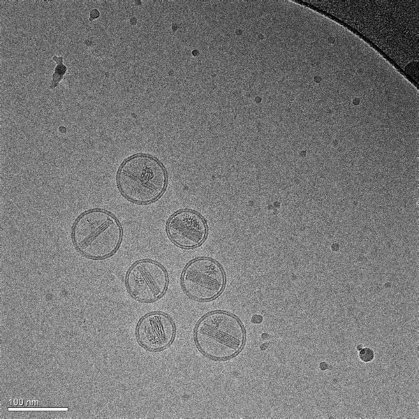 Mikrograf Pořízený Kryogenním Elektronovým Mikroskopem Nanočástice Vyrobené Lipidů Lipozomů Obsahujících — Stock fotografie