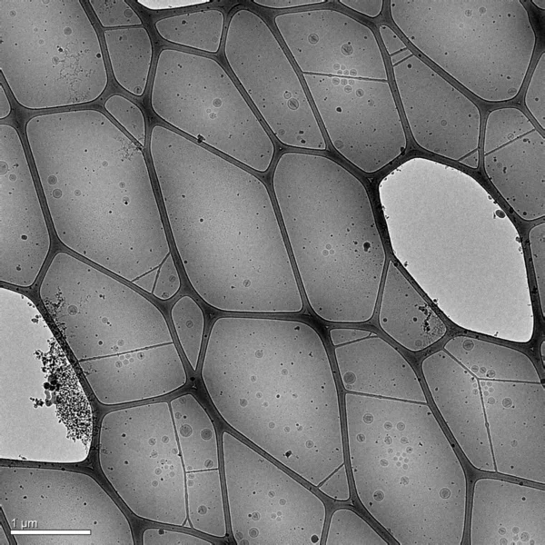 Una Imagen Con Microscopio Electrónico Criogénico Varias Nanopartículas Hechas Lípidos —  Fotos de Stock
