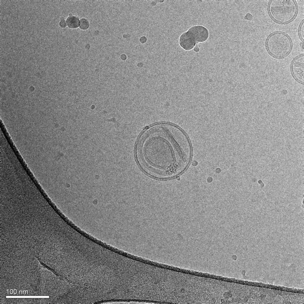 Ett Skott Med Ett Kryogent Elektronmikroskop Flera Nanopartiklar Lipider Liposomer — Stockfoto