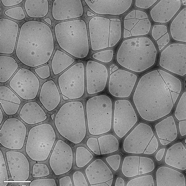 Imagen Electrónica Nanopartículas Hechas Lípidos Que Contienen Fármaco Anticanceroso Doxorrubicina —  Fotos de Stock