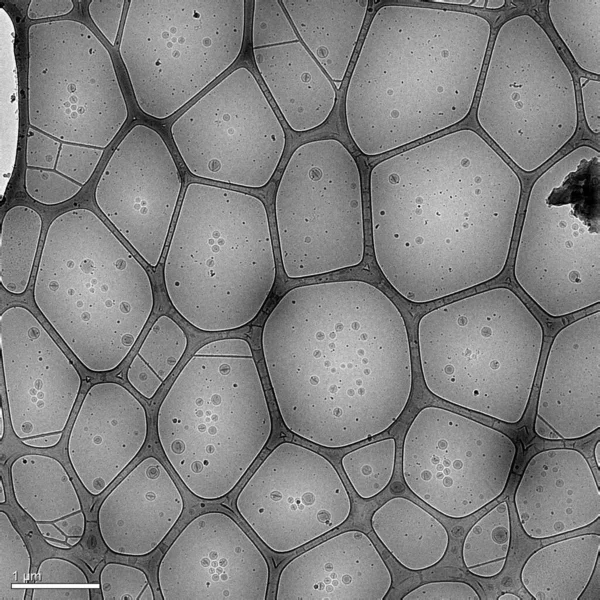 Imagen Fue Tomada Con Microscopio Electrónico Criogénico Representa Nanopartículas Hechas —  Fotos de Stock