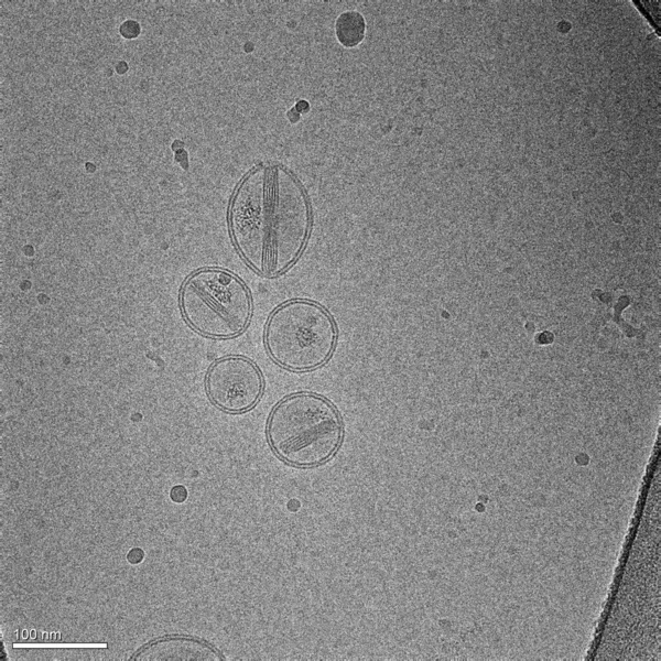 Bild Tagen Med Ett Kryogent Elektronmikroskop Det Representerar Flera Nanopartiklar — Stockfoto