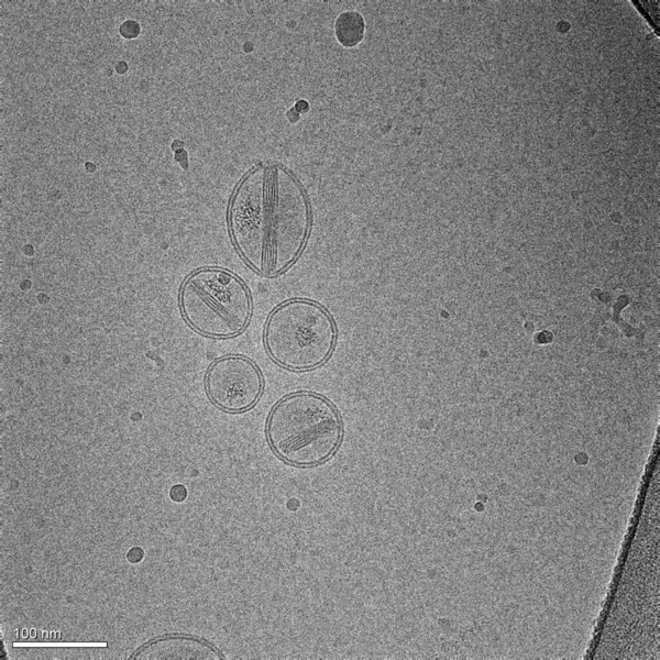 Een Beeld Genomen Met Een Cryogene Elektronenmicroscoop Het Vertegenwoordigt Verscheidene — Stockfoto