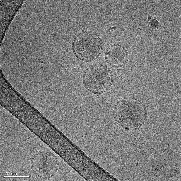 Imagen Electrónica Nanopartículas Hechas Lípidos Que Contienen Medicamento Contra Cáncer — Foto de Stock