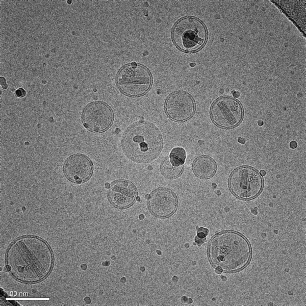 Mikrograf Nanopartiklar Gjorda Lipider Som Innehåller Ett Cancerläkemedel Drogen Visas — Stockfoto