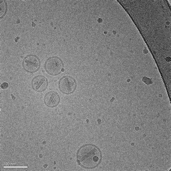 Een Micrograaf Van Nanodeeltjes Gemaakt Van Lipiden Die Een Middel — Stockfoto