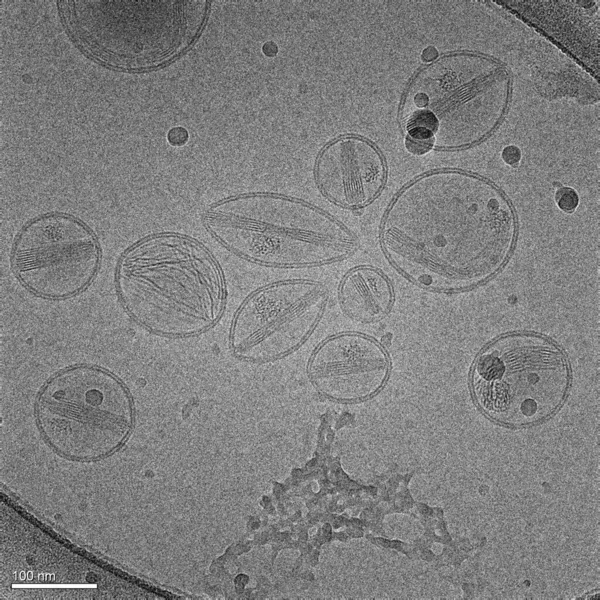 Una Imagen Electrónica Representa Varias Nanopartículas Hechas Lípidos Liposomas Que —  Fotos de Stock