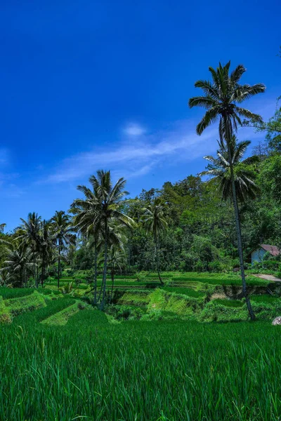 Een Verticaal Shot Van Tropische Palmbomen Het Park — Stockfoto