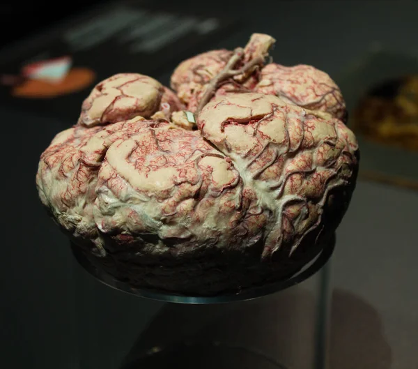 Yapay Bir Insan Beyninin Yakın Plan Fotoğrafı — Stok fotoğraf