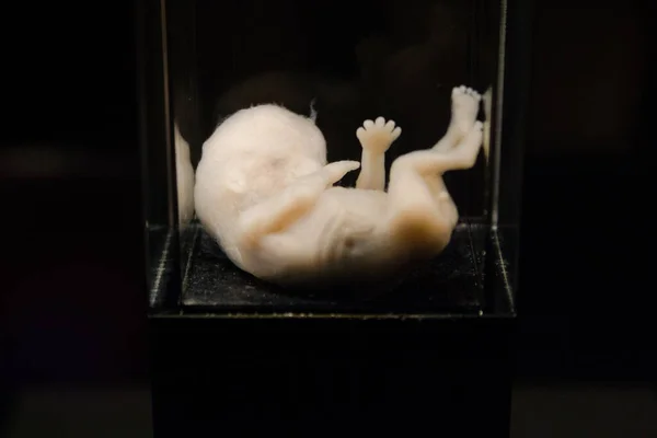 Gros Plan Fœtus Humain Dans Musée — Photo
