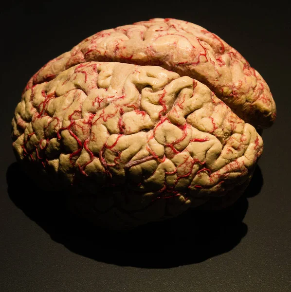 Tiro Perto Cérebro Humano Plastinado — Fotografia de Stock