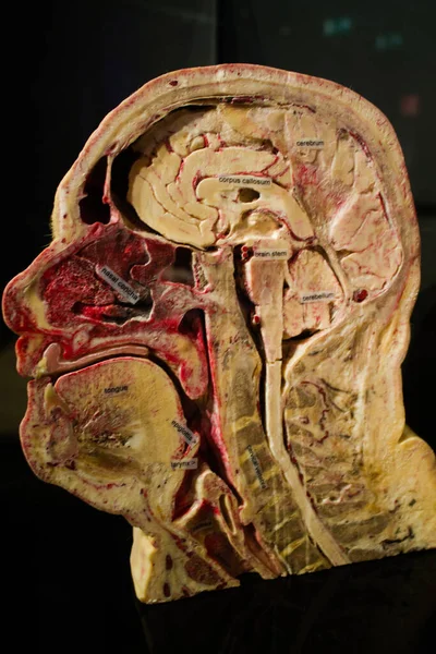 Disparo Vertical Esqueleto Músculos Artificiales Cabeza Humana —  Fotos de Stock