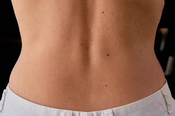 Mature Woman Skin Spots Moles Her Back — Stockfoto