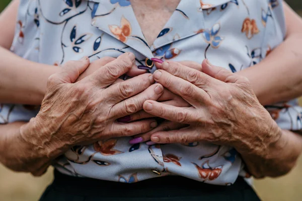 Primer Plano Las Manos Venosas Una Anciana Sosteniendo Las Manos — Foto de Stock