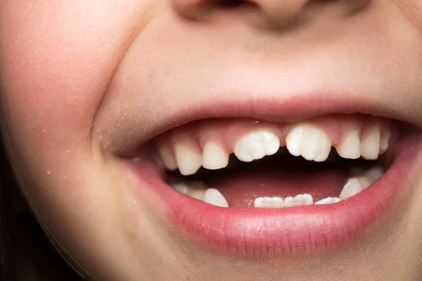 Uma Foto Close Rosto Uma Criança Sorridente Com Novos Dentes — Fotografia de Stock