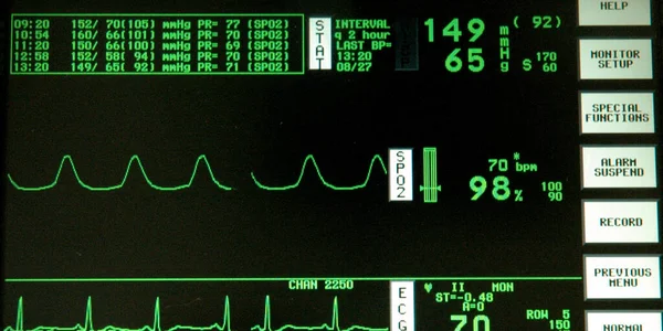 Monitor Ecg Nella Sala Ricovero Ospedaliero — Foto Stock