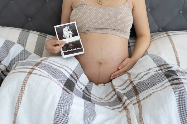 Pregnant Woman Holding Ultrasound Button Belly — Stock Photo, Image