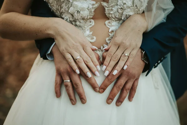 Anéis Casamento Nas Mãos Noiva — Fotografia de Stock