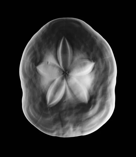 Bir Insan Beyninin Boyutlu Canlandırması — Stok fotoğraf