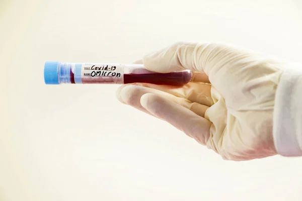 Hand Hält Ein Reagenzglas Mit Einer Probe Eines Impfstoffs — Stockfoto