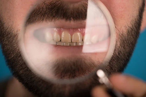 Homem Com Aparelho Nos Dentes — Fotografia de Stock