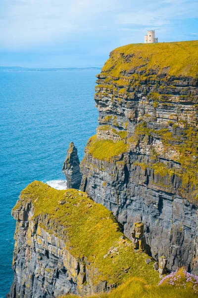 Gyönyörű Táj Hegyekben Írország Szigetén — Stock Fotó