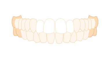 Diş protezi, ön ön ön taraftaki ön taraftaki insanın yakın görüntüsünü ayarlar. Dişli çene modeli. Bir dizi mankafa gerçekçi daire.