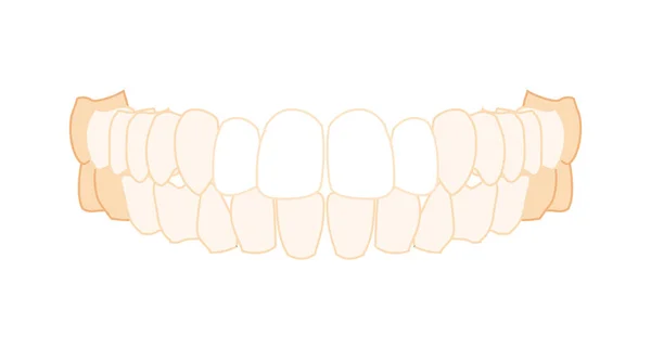 Teeth row Denture Set Closeup Human front anterior ventral view. Jaws model with teeth. Set of chump realistic flat — Image vectorielle