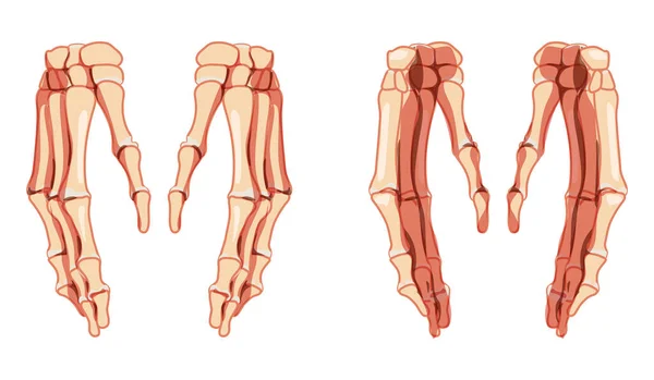 手骷髅人类的前视镜。一组心室，手腕，掌骨，指节。解剖上正确的3D真实感 — 图库矢量图片