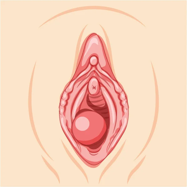 Bartholins Cyst Gland Female Reproductive System Uterus Front View Human — Vector de stock