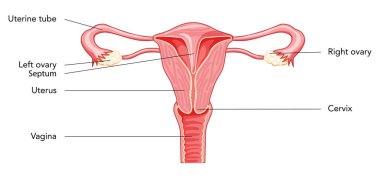 Uterine septum septate uterus Dişi üreme sistemi diyagramı ile yazı metni. İnsan anatomisi iç organları şeması, rahim ağzı, yumurtalık, fallop tüpü düz taşıyıcı tıbbi illüstrasyon izole edildi.