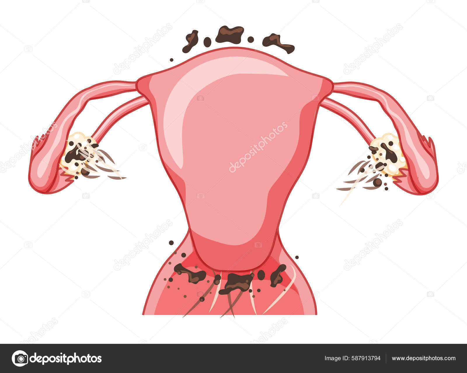 42 Dismenorrea-stockillustrasjoner | DepositPhotos, image size:1600x1279