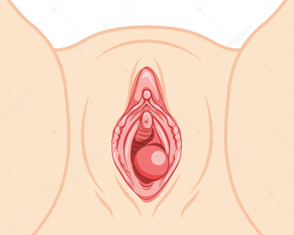 Bartholins cyst gland Female reproductive system uterus. Front view. Human Surface anatomy of the perineum external organs location scheme, vagina pain vulva blockage flat style icon