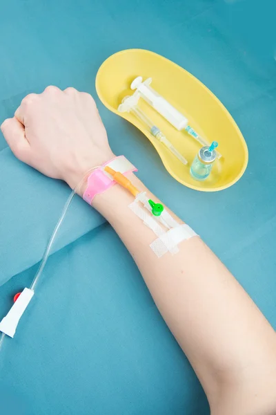 Intravenös injektion, dropp av läkemedlet — Stockfoto