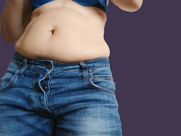 썩었어 지방이 청바지 허리에 과식이나 임신을 것이다 당뇨병입니다 보라색 킬레이트 — 스톡 사진