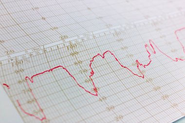 Termometre kayıt grafiği