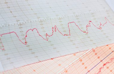 Termometre kayıt grafiği