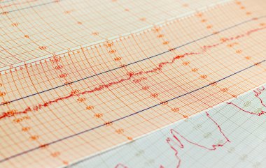 Termometre kayıt grafiği