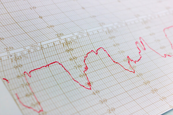 Граф термометра
