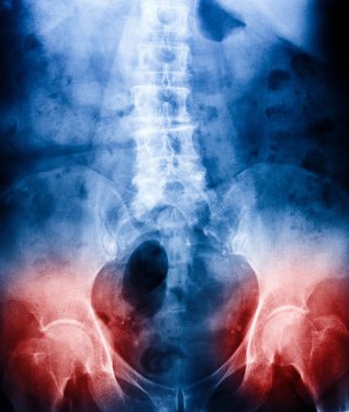 x-ray tarama insan